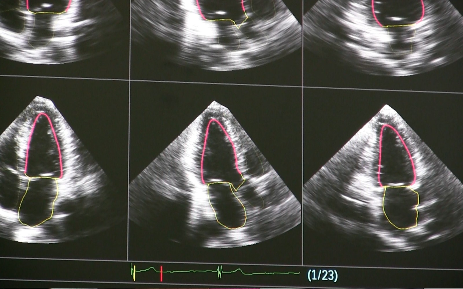 3D C-Arm Imaging Systems Financing