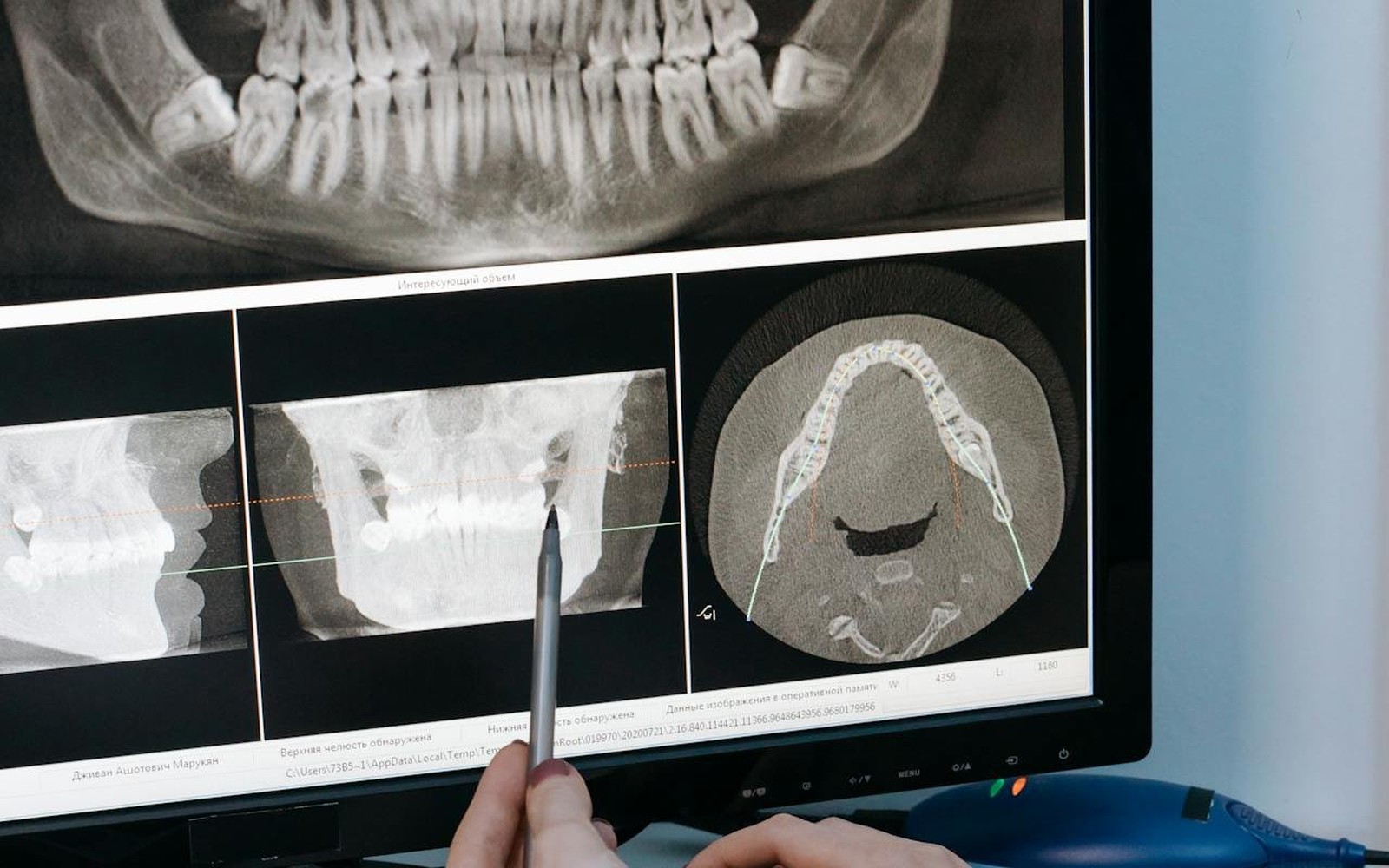 Cone-Beam CT (CBCT) Systems Financing