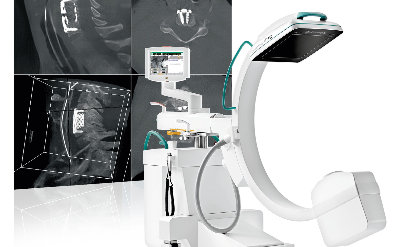 Ziehm Vision RFD C-Arm Financing